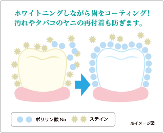 ホワイトニングしながら歯をコーティング！　汚れやタバコのヤニの再付着も防ぎます。
